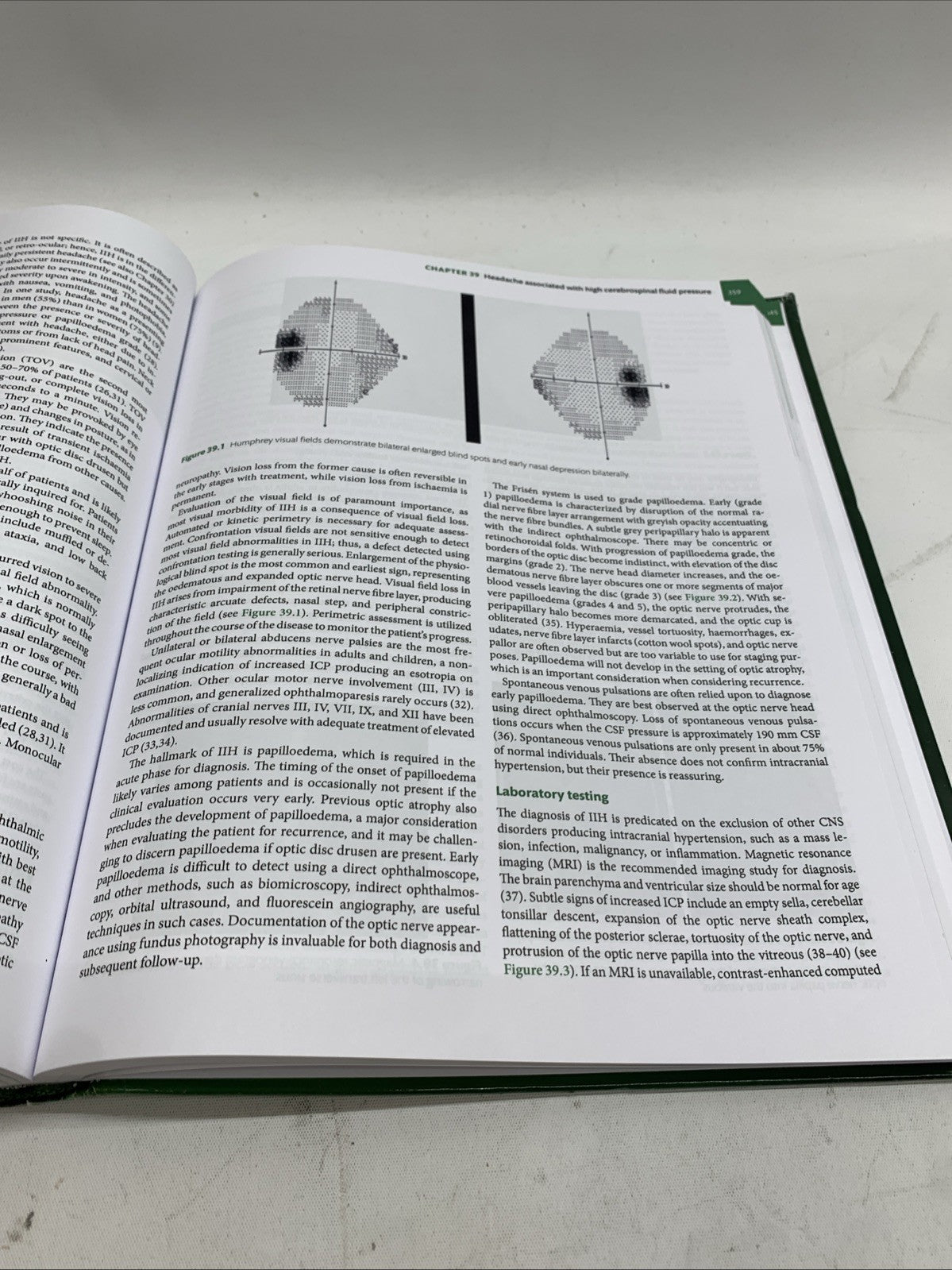 Oxford Textbook of Headache Syndromes by Ferrari, Haan, Charles, Dodick  - GOOD
