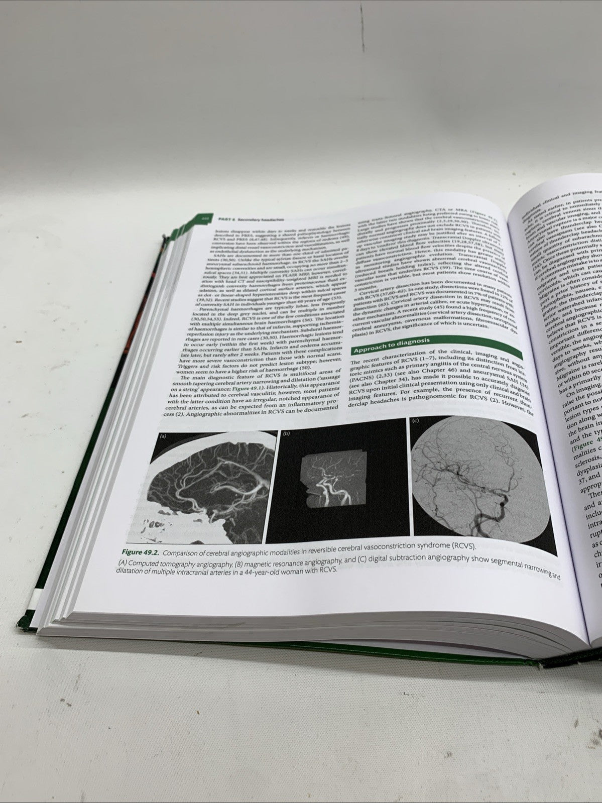 Oxford Textbook of Headache Syndromes by Ferrari, Haan, Charles, Dodick  - GOOD