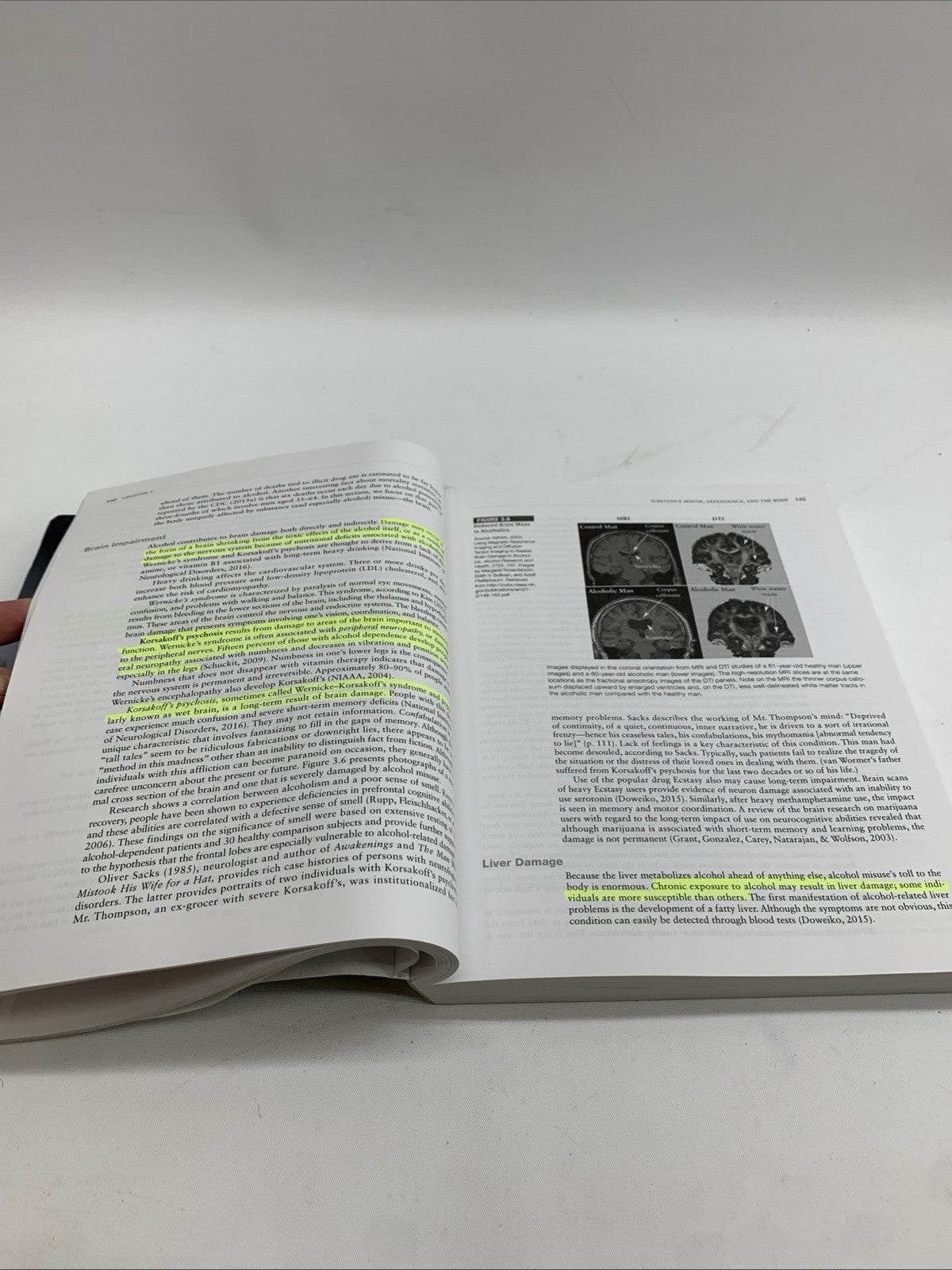 MindTap Course List Ser.: Addiction Treatment: a Strengths Perspective by Diane